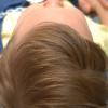Postoperative appearance