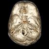 Postoperative imaging of the skull base. The outline is smoothed